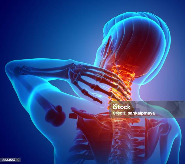 Männlich Gefühl Schmerzen Im Nacken Stockfoto und mehr Bilder von Nackenschmerzen - Nackenschmerzen, Schmerz, Verletzung