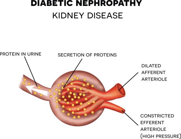 diabetes nefropati, anatomi glomerulus - ginjal binatang ilustrasi stok