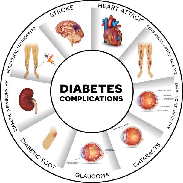 Diabetes complications Diabetes complications affected organs. Diabetes affects nerves, kidneys, eyes, vessels, heart, brain and skin. Round info graphic. complexity stock illustrations