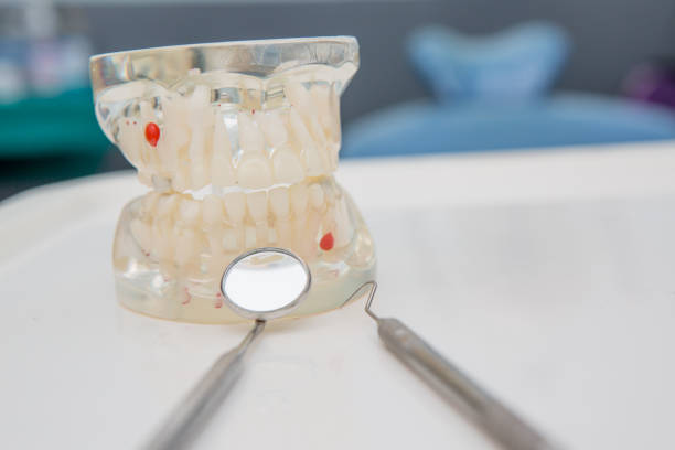 istock Dental Teeth Model and dental tool 653792352