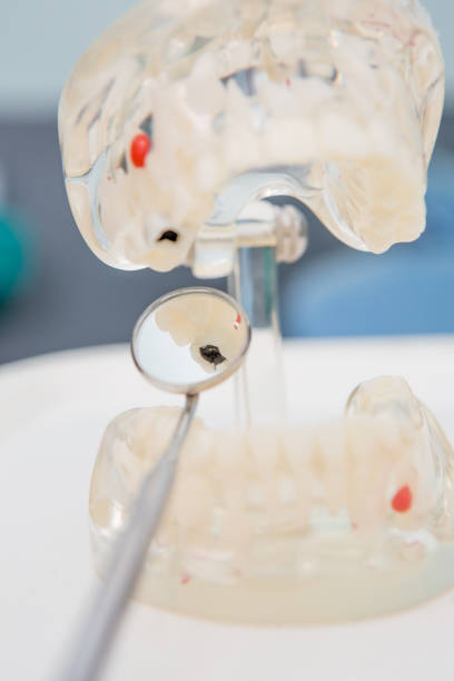 istock Dental Teeth Model and dental tool 653794078