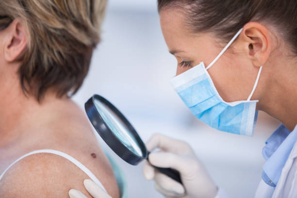 Dermatologist examining mole of female patient with magnifying glass Dermatologist examining mole of female patient with magnifying glass in clinic skin cancer stock pictures, royalty-free photos & images