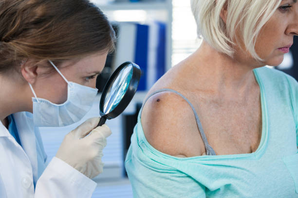 istock Dermatologist examining mole of female patient with magnifying glass 653852138