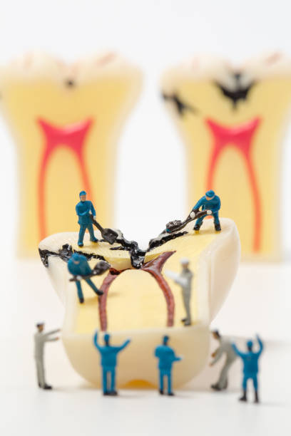 istock miniature people to clean tooth model on white background 653888380