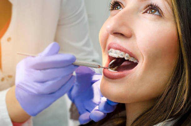 Closeup of beautiful girl with dental braces check up Closeup of beautiful girl with dental braces check up, satisfied smiling, while doctor looking her teeth human teeth stock pictures, royalty-free photos & images