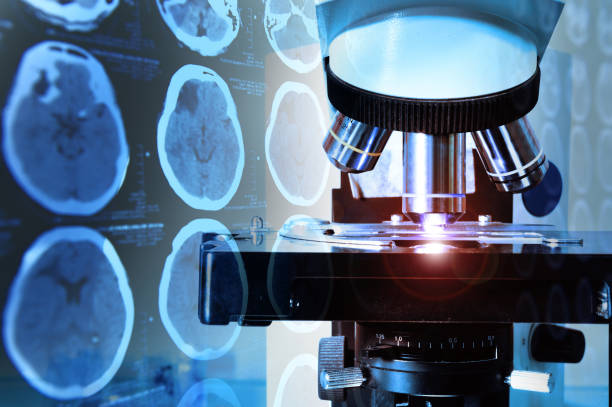 istock close up shot of microscope at the blood laboratory and images from a computerized tomography of the brain 654135096