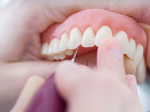 Dental technician is working with porcelain teeth in a cast molde in dental laboratory.