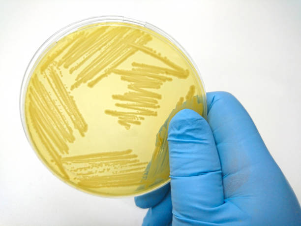 istock Colony of bacteria in culture medium plate 654450390