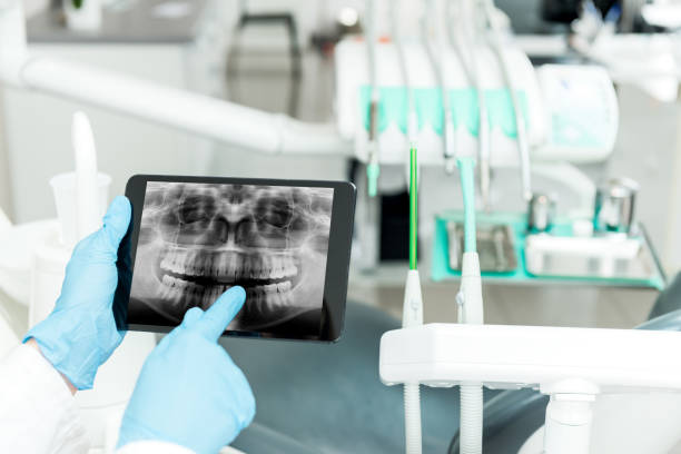 стоматологическая радиограмма на планшете - dentist dentist office human teeth dental equipment стоковые фото и изображения