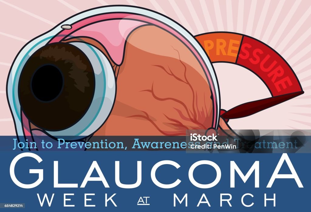 Eyeball with Manometer to Commemorate Glaucoma Week Banner for Glaucoma Week with eyeball and a manometer showing the importance of the control of intraocular high pressure in this disease treatment. Alertness stock vector