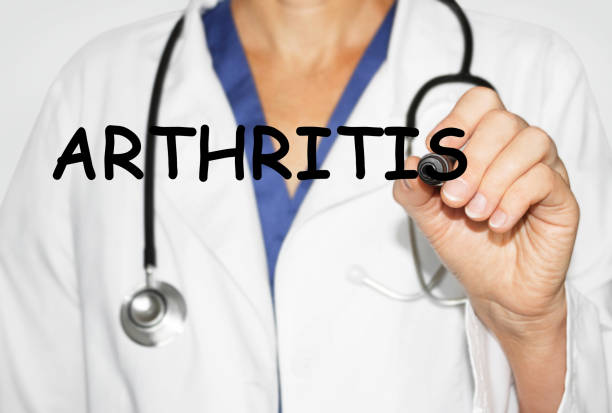 istock Doctor writing word Arthritis, Medical concept 655113608