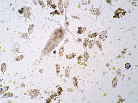 Freshwater aquatic plankton under microscope view