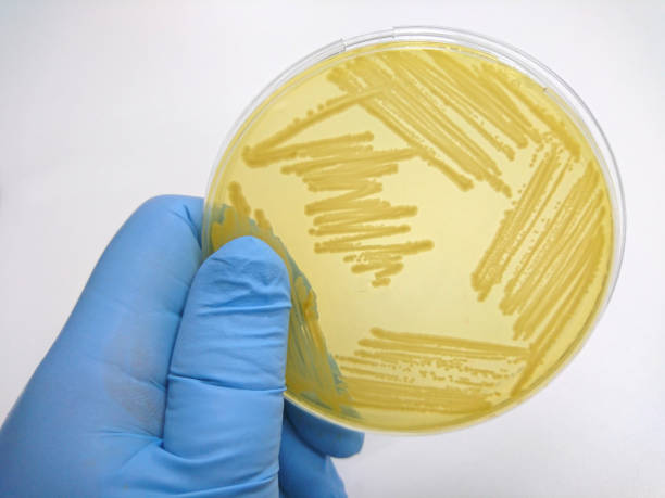 istock Colony of bacteria in culture medium plate 655248584