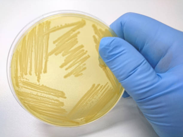 istock Colony of bacteria in culture medium plate 655248658