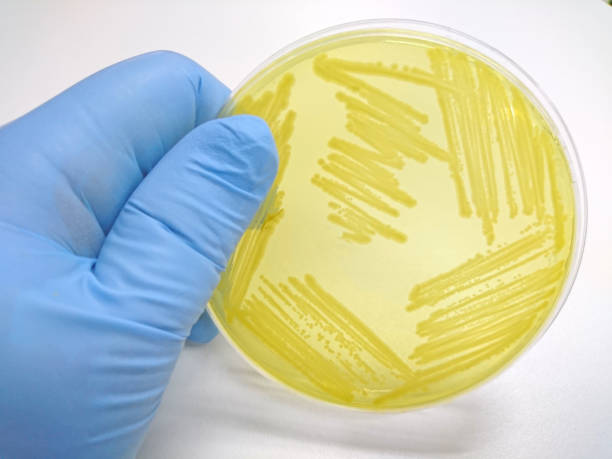 istock Colony of bacteria in culture medium plate 655248746