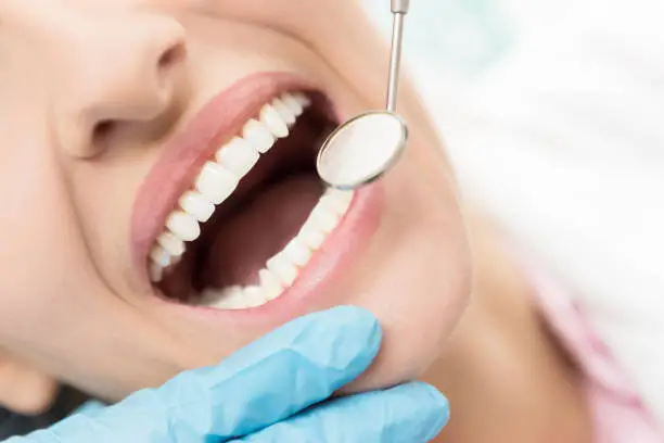 Horizontal close-up image of woman having dental examination.