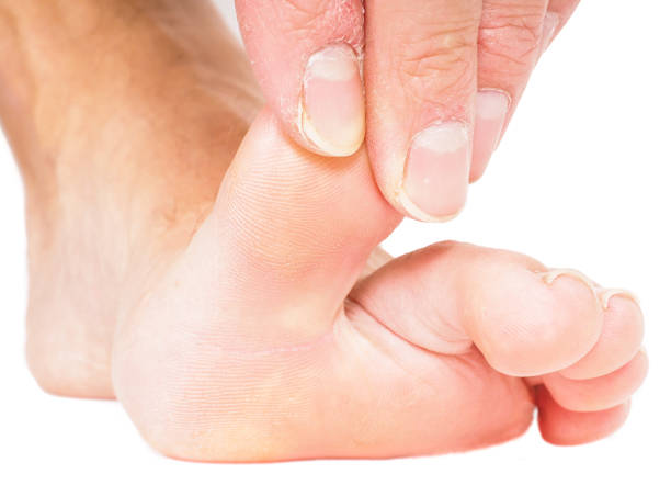 istock Male person pulling big toe backwards isolated towards white 655484664