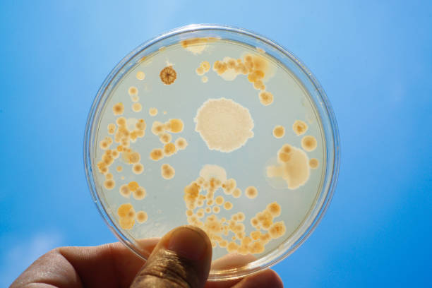 istock Colony of bacteria in culture medium plate 655785074