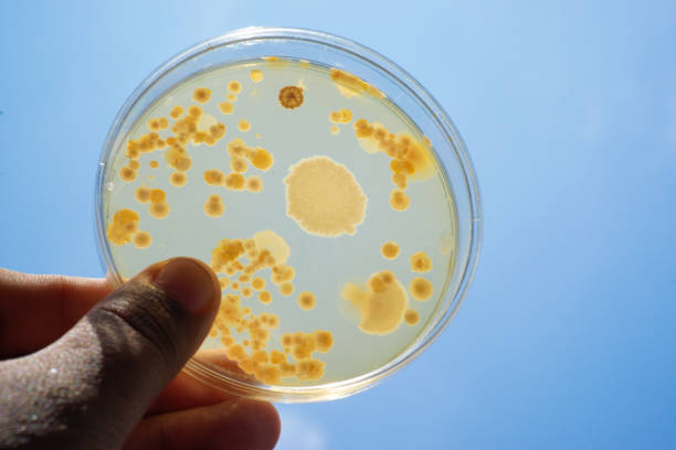 istock Colony of bacteria in culture medium plate 655787094