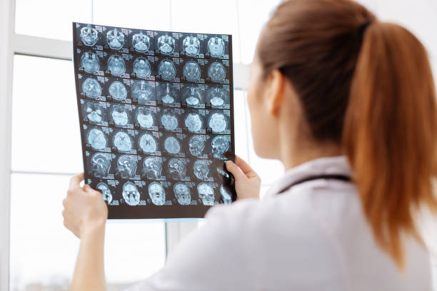 istock Careful excellent doctor having a better look at brain scans 656606948