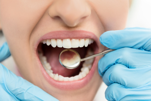 Horizontal color close-up image of young woman having dental exam.