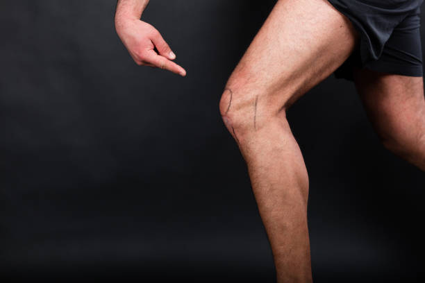 rodilla izquierda con el dibujo de la rótula - cruciate ligament fotografías e imágenes de stock