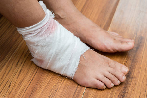 istock lady with a wrapped foot on floor 656855648