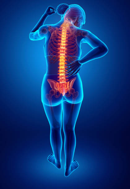 mujeres sienten el dolor de espalda - hilight fotografías e imágenes de stock