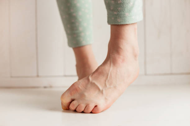 istock Women's tired ankles with clasped fingers and bulging veins close-up on a light background. 656892666