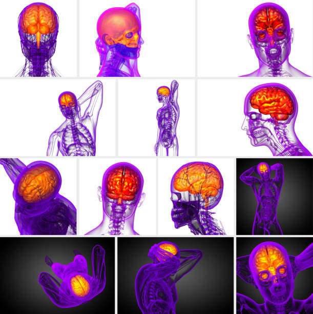 istock 3d rendering medical illustration of the brain 656971624