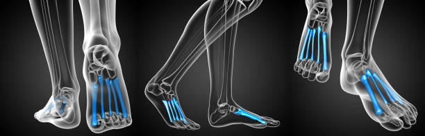 istock 3d rendering medical illustration of the metatarsal bones 656975012