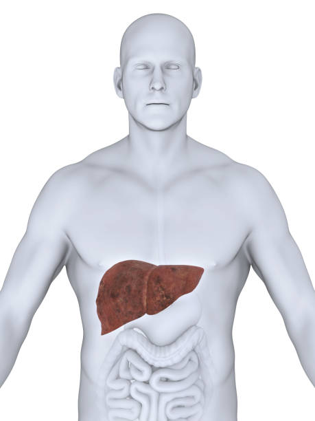 istock Unhealthy Liver Anatomy 656975028