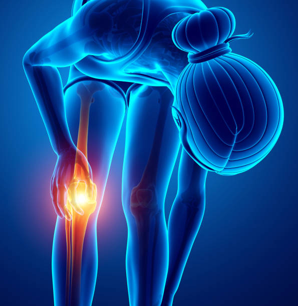 istock Women Knee joint pain 657261496