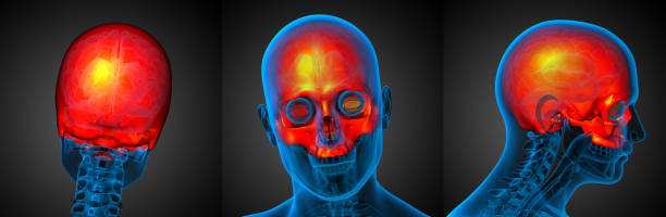 istock 3d rendering medical illustration of the upper skull 657719966