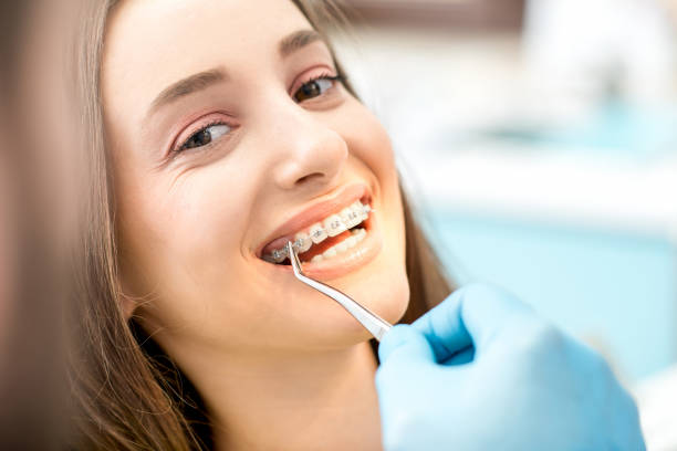 Woman's smile with dental braces Putting dental braces to the woman's teeth at the dental office orthodontist consultation stock pictures, royalty-free photos & images