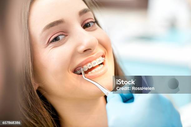 Womans Smile With Dental Braces Stock Photo - Download Image Now - Dental Braces, Orthodontist, Dentist
