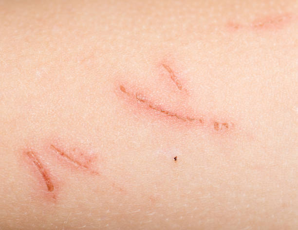 istock a wound on the skin. close 657921046