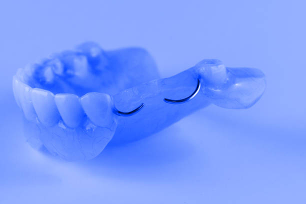 istock acrylic denture with metal clasps 657950146
