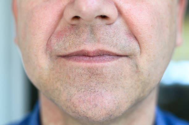 cara inferior de una mediana edad con labios entreabiertos - piel enrojecida fotografías e imágenes de stock