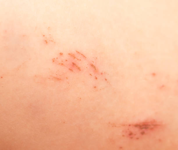 istock a wound on the skin. close 658259162