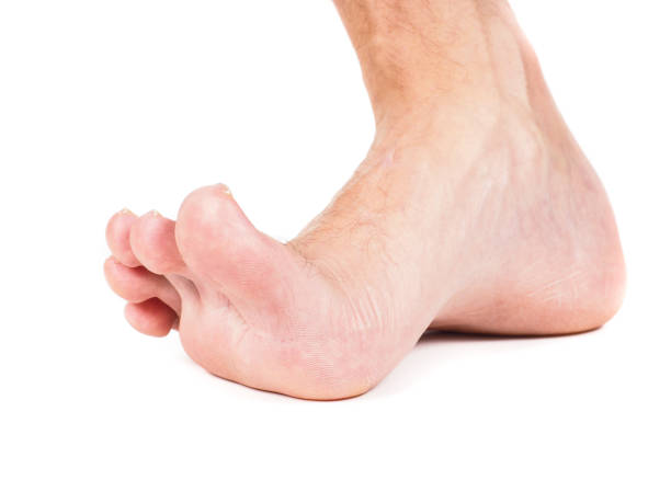 istock Male foot stepping barefooted towards camera 658277696
