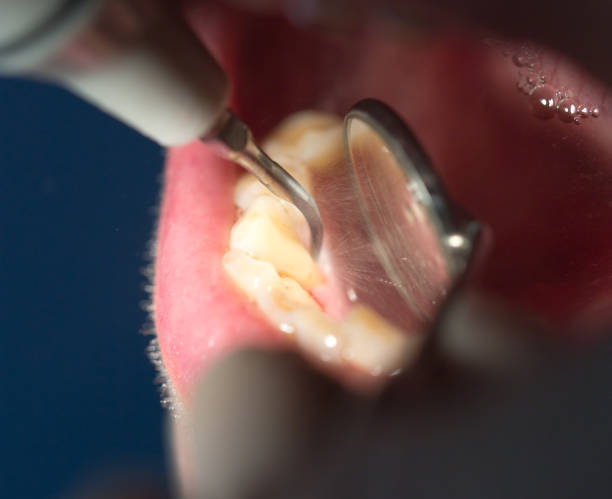istock dental treatment in dentistry 658870554