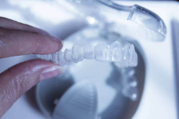 istock Part of an invisible dental corrector 659075226