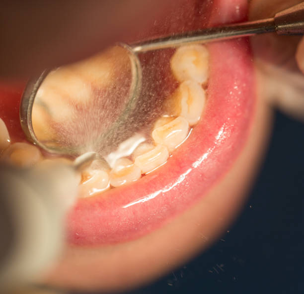 istock dental treatment in dentistry 659515580