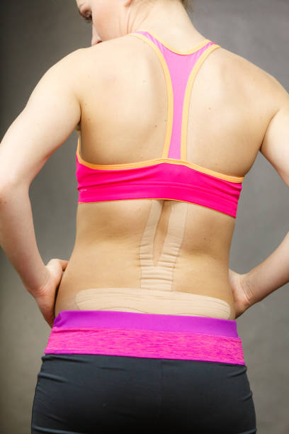 istock Woman with medical kinesio taping on back 660131318