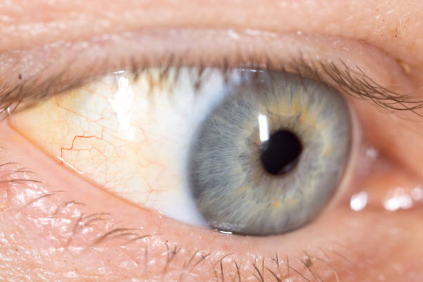 istock veins in the eyes of men 660311238