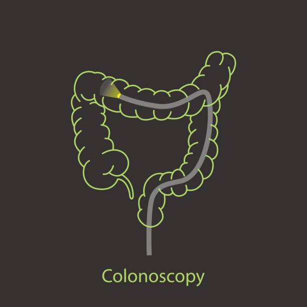 colonoscopy logo vector icon design vector art illustration