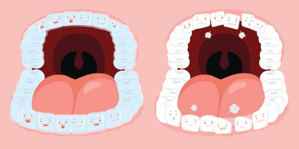 Kawaii Invisalign 160+ Invisalign Cartoon Stock Illustrations, Royalty-Free Vector ...