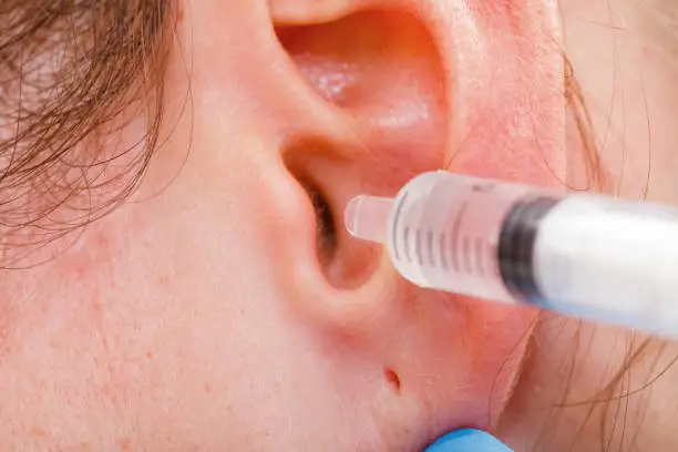 Medical ear wash with water in syringe