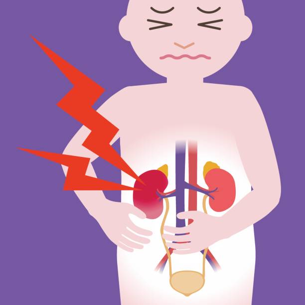 ilustrações, clipart, desenhos animados e ícones de inflamação dos rins, órgãos urinários humanos, coração, rim, bexiga, ilustração vetorial - kidney stone